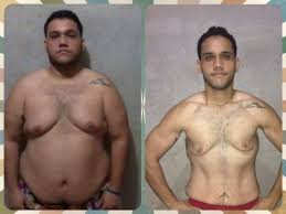 antes-e-depois-mounjaro